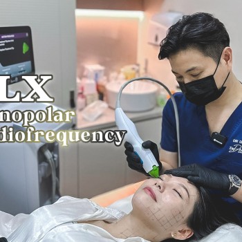 thermage skin tightening near me